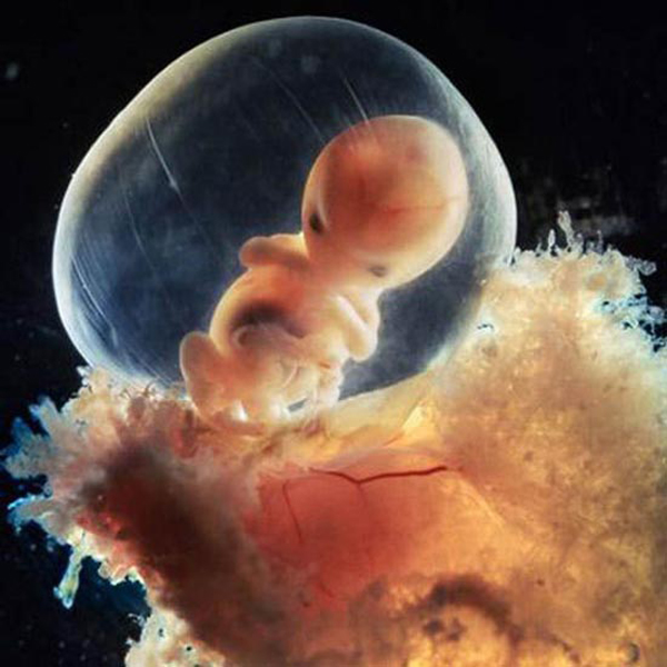 От зачатия до рождения. Удивительные фото
