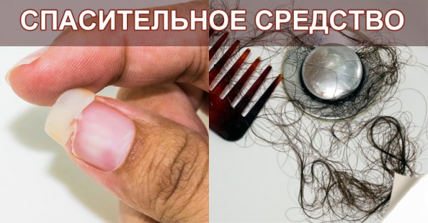 Простое решение проблемы выпадения волос, ломкости ногтей и бессонницы!