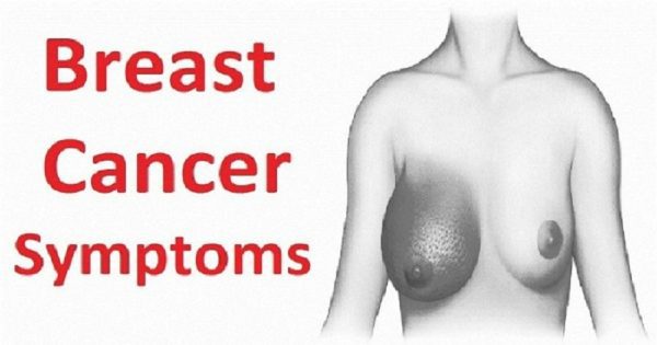 5 признаков рака молочной железы, которые многие женщины игнорируют!