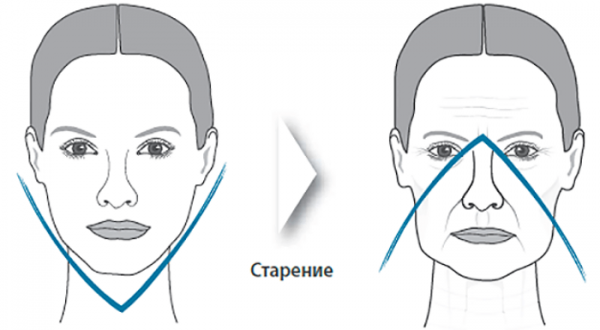 Как подтянуть обвисшие щеки и восстановить контур лица