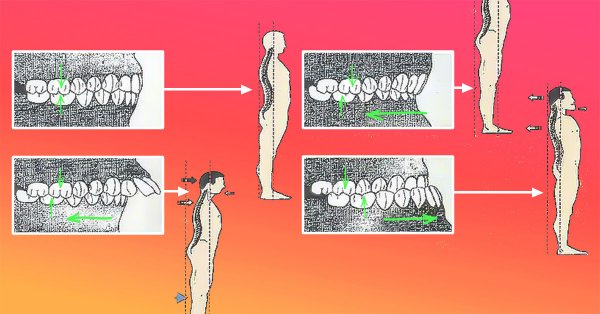 Челюсть и позвоночник неразрывно связаны: если болит спина, нужно лечить зубы!