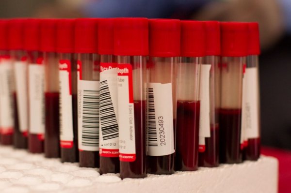 Вот 11 показателей крови, которые вы обязаны знать после 30