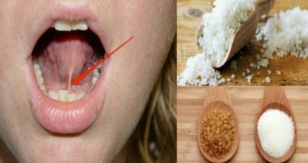 Просто поместите солево-сахарную смесь под языком перед тем, как отправиться спать и то, что произойдет — удивительно!