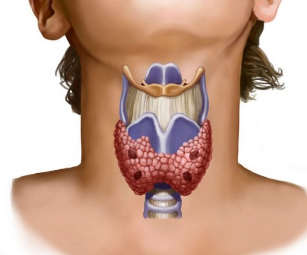 8 вещей в вашем доме, которые наносят вред вашей щитовидной железе!